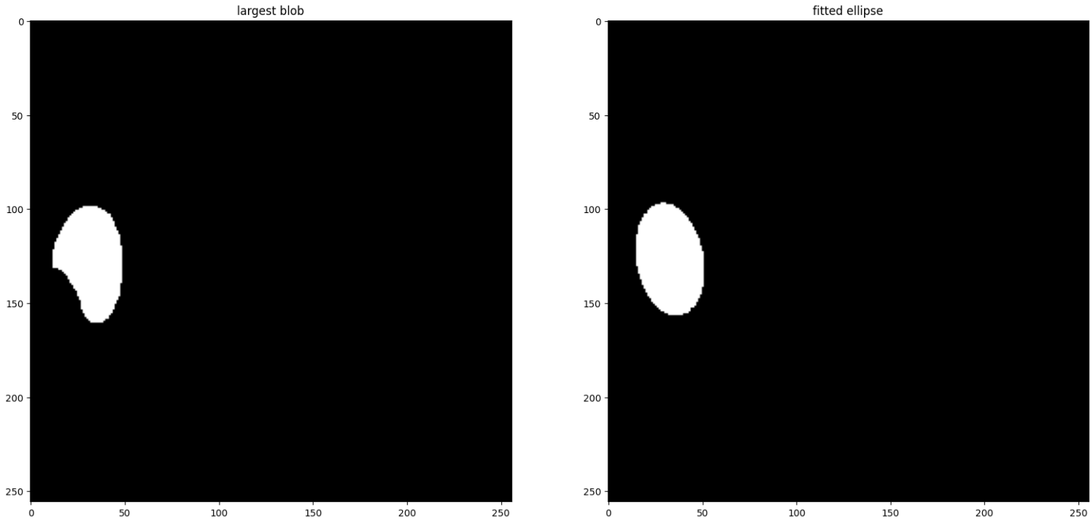 Cup detection refinement